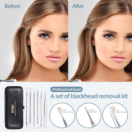 JPNK Blackhead Remover Comedone Extractor Acne Removal Kit..