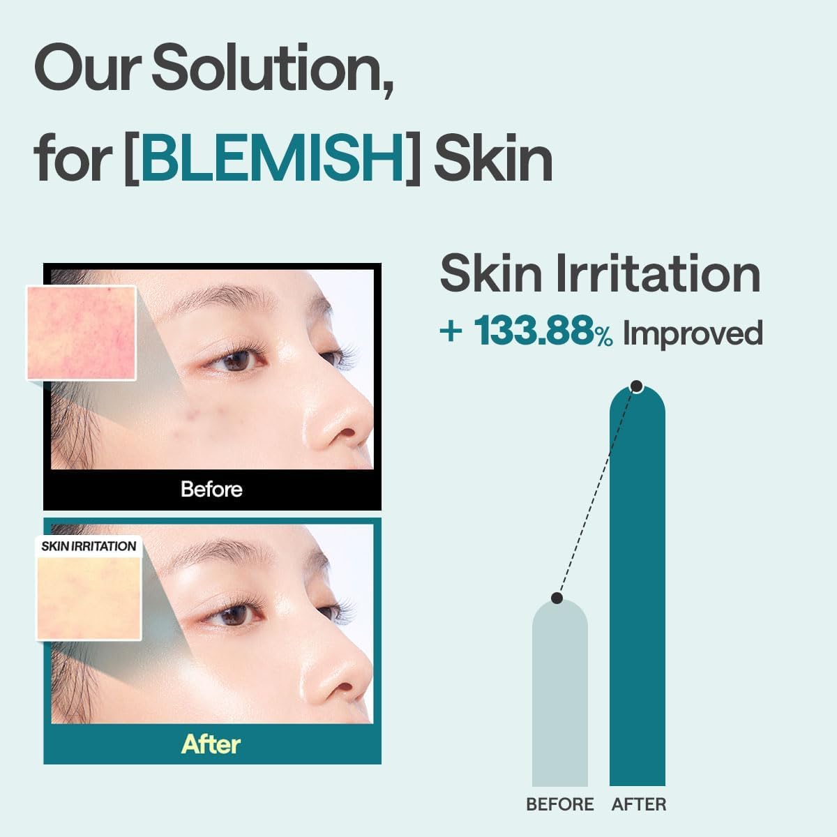 Mediheal Essential Face Mask [Madecassoside] Blemish Repair 10 pcs. wi
