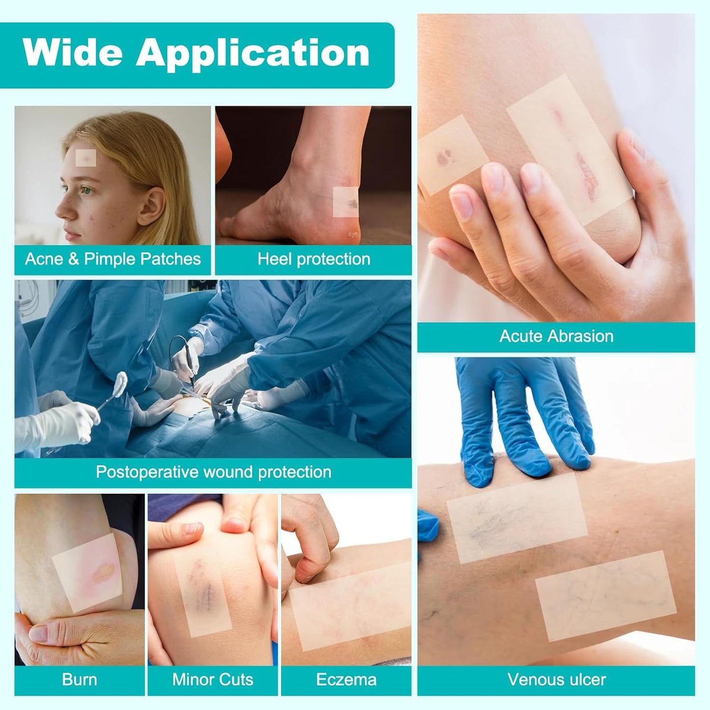 Hydrocolloid Roll for Wound Care, Hydrocolloid Bandages with Self-Adhe