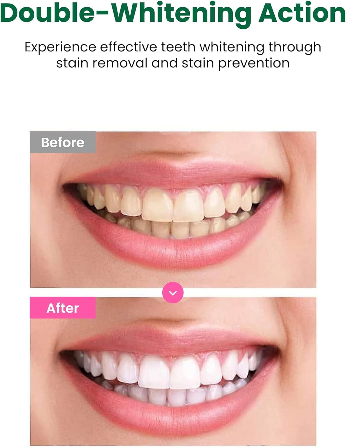 EUTHYMOL Whitening Toothpaste (3.7fl oz) - Stain Removal in 2 Weeks, L