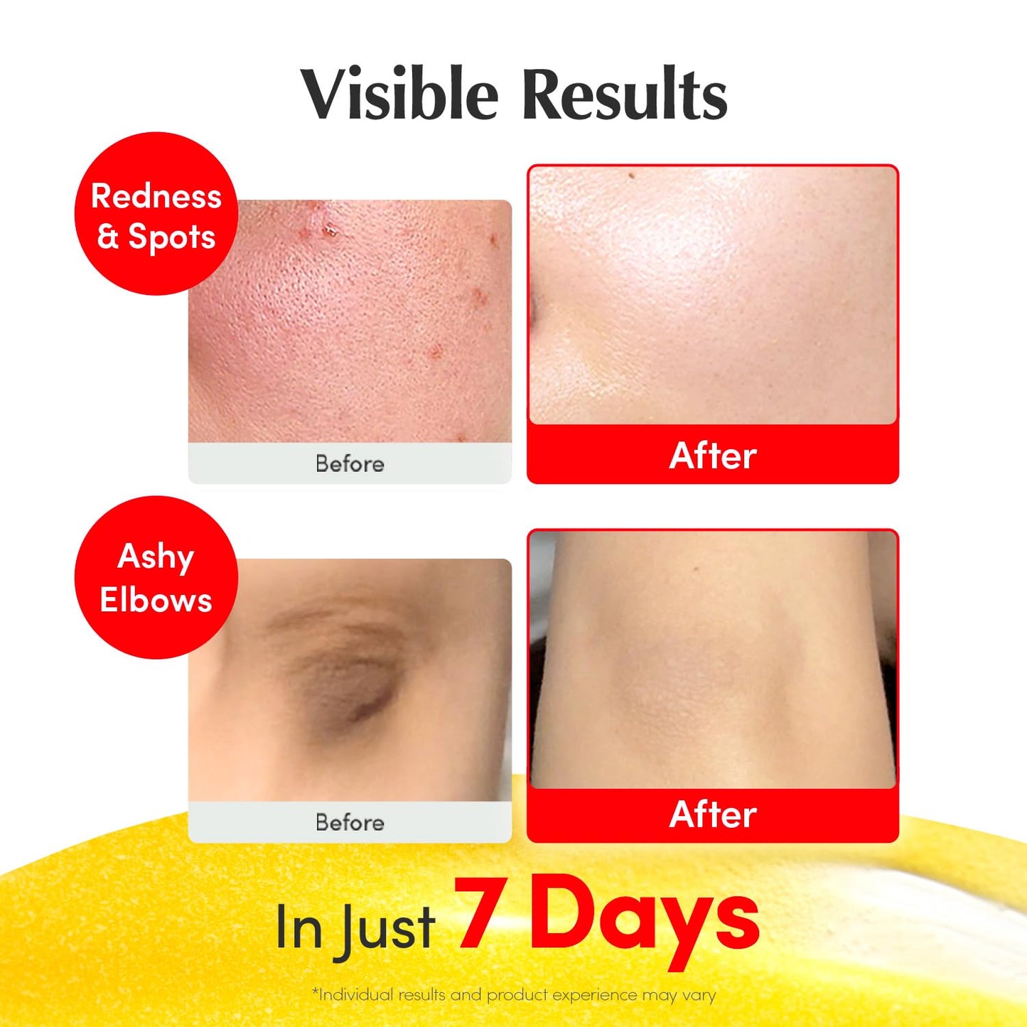 EQQUALBERRY Vitamin Illuminating Serum | Niacinamide 4% + Brightening 