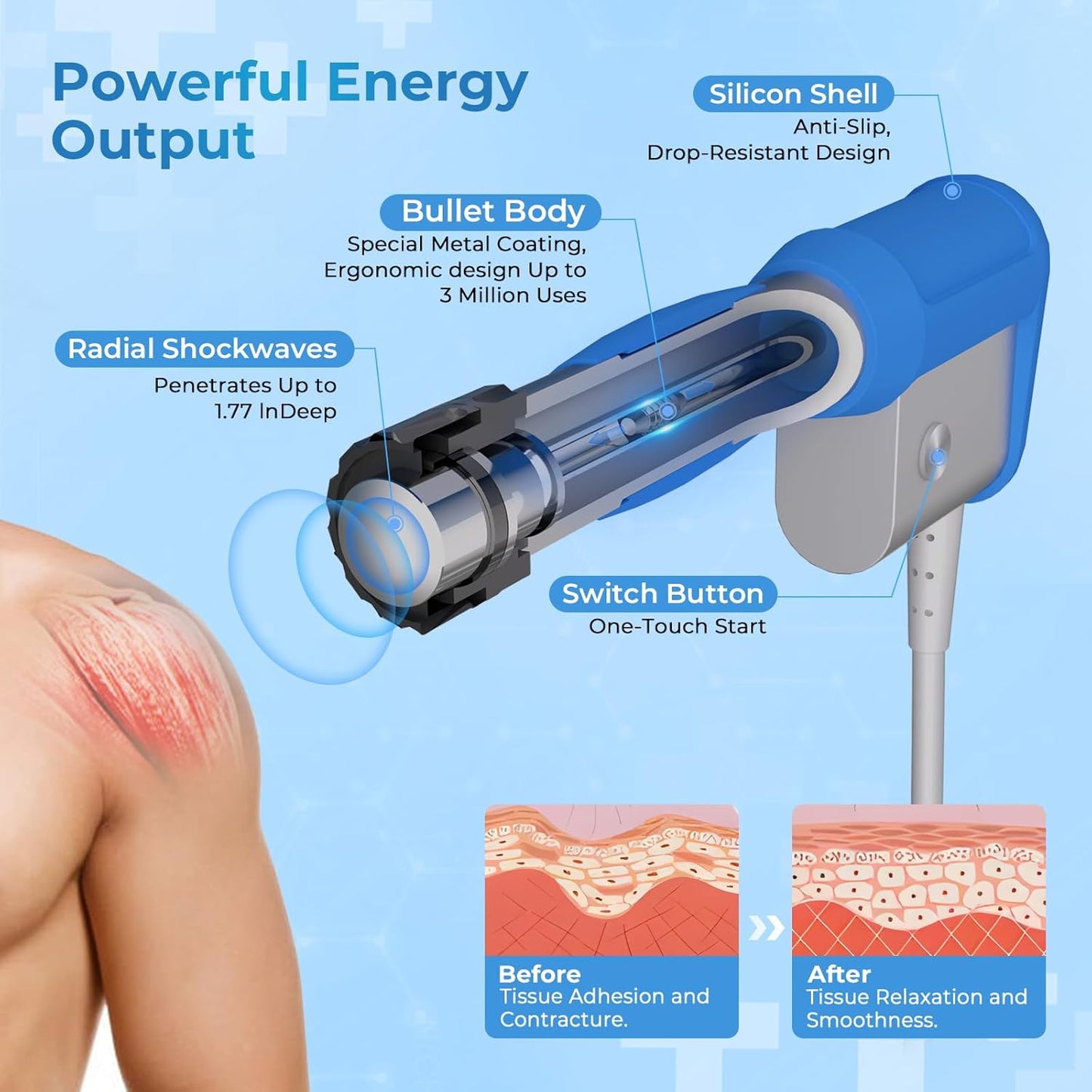 2026 New Upgraded Shockwave Therapy Machine, Extracorporeal Shock Wave