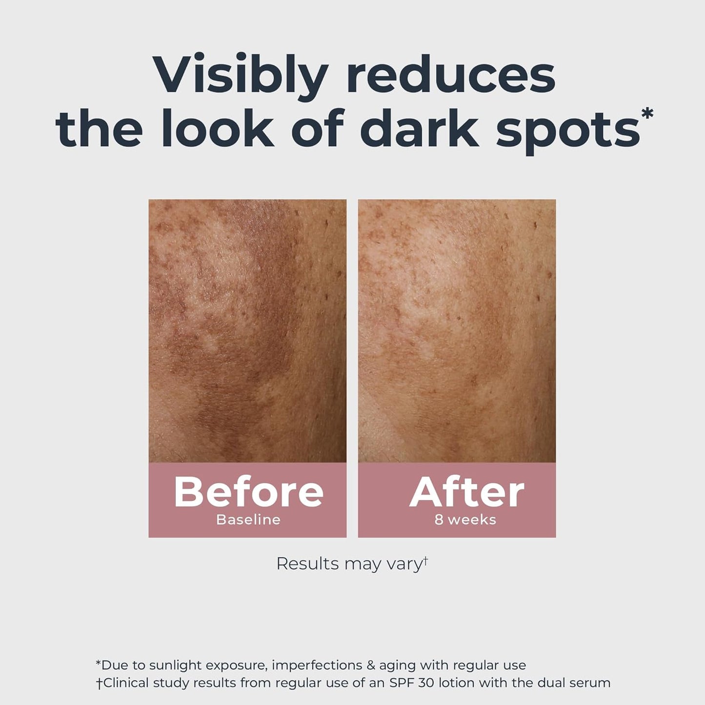 Eucerin Radiant Tone Dual Serum Dark Spot Corrector, Dark Spot Serum w