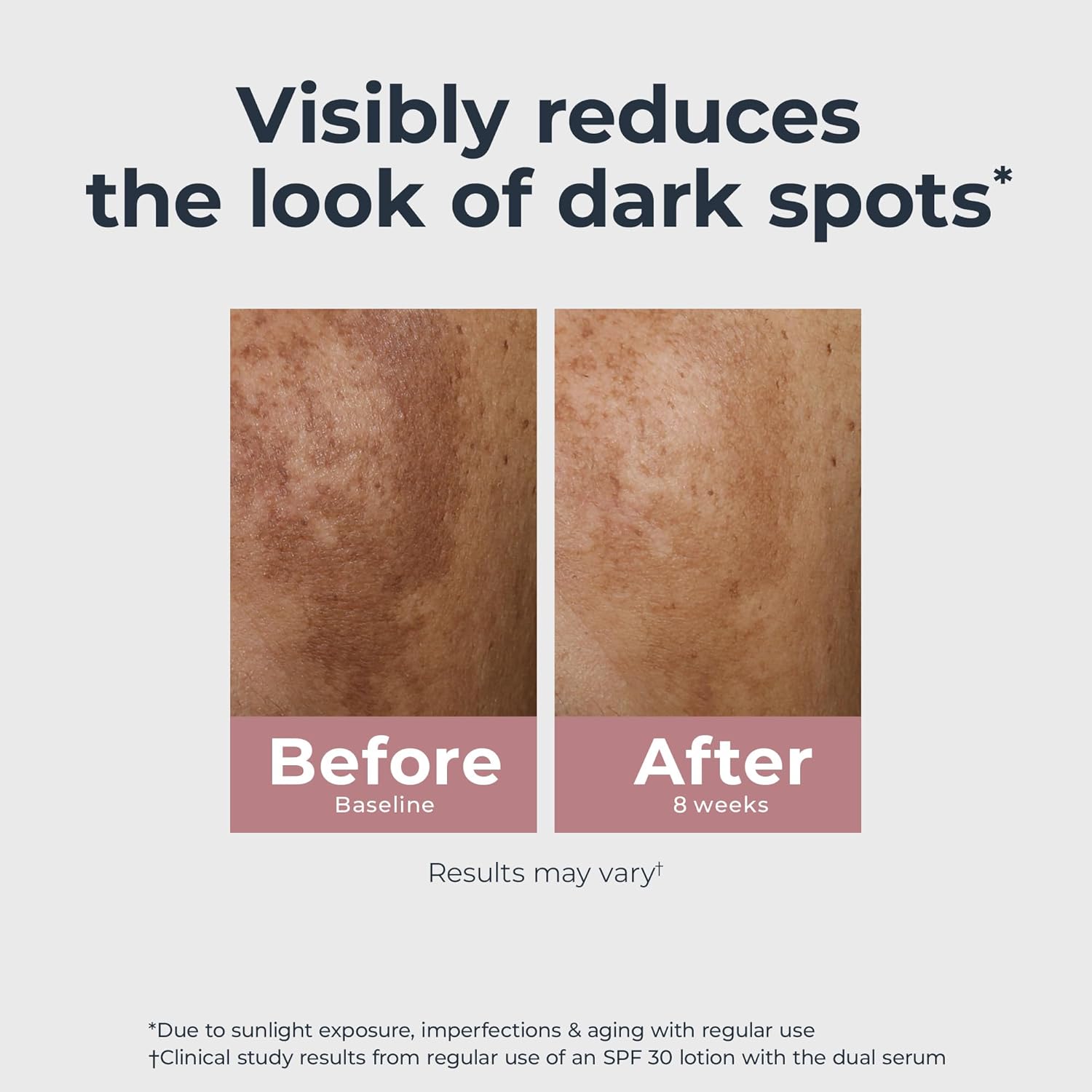 Eucerin Radiant Tone Dual Serum Dark Spot Corrector, Dark Spot Serum w
