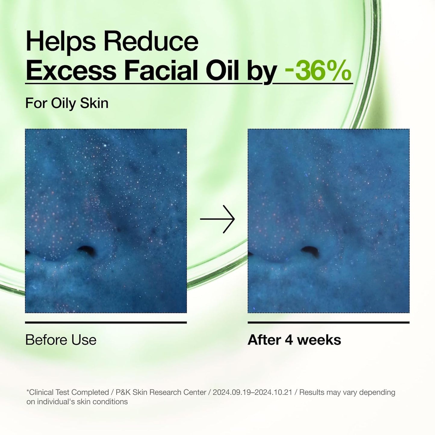 Anua Azelaic Acid 10 Hyaluron Redness Soothing Serum, Facial Serum for
