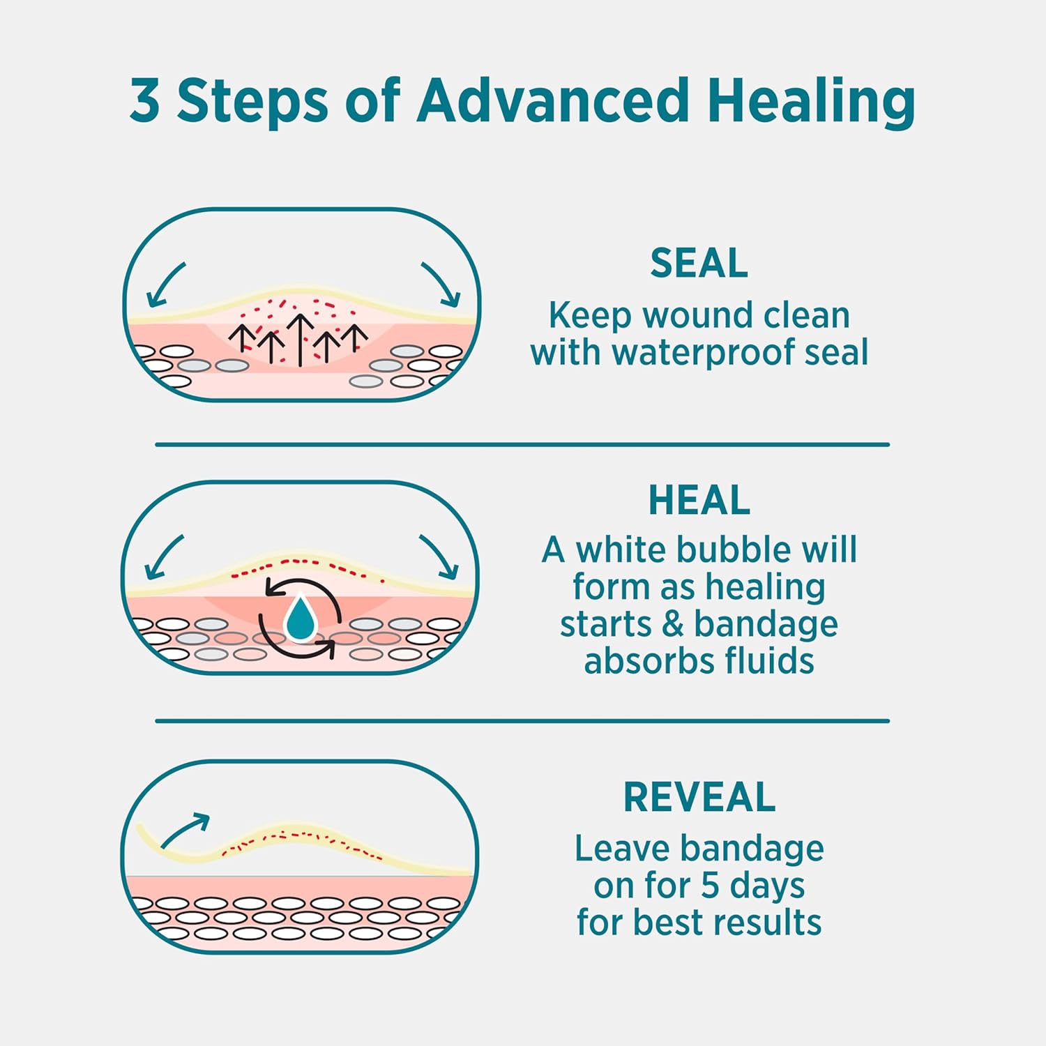 BAND-AID Brand Pro Heal Hydrocolloid Blister Bandages for Advanced Hea