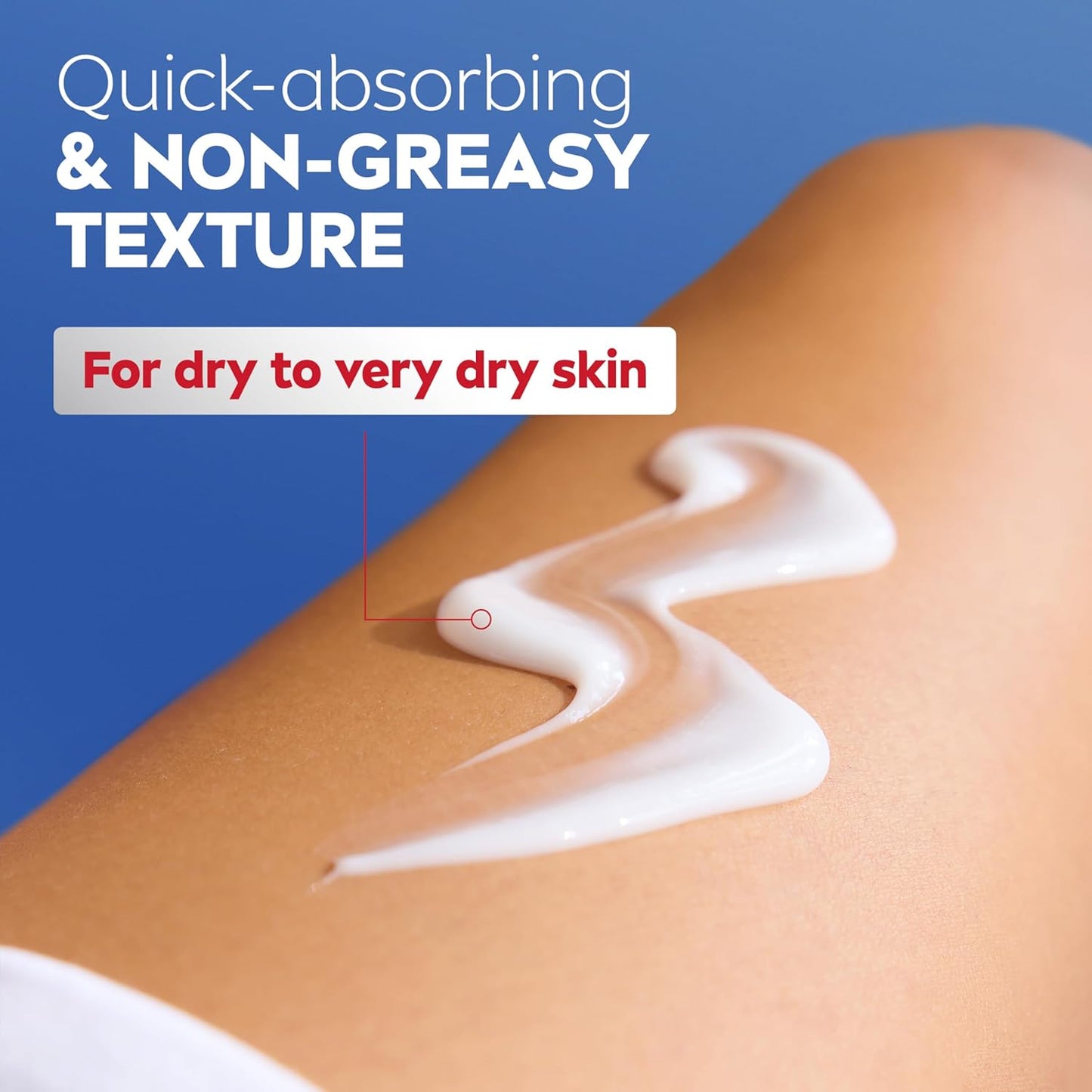 NIVEA Intense Healing Body Lotion for Very Dry, Itchy Skin with Glycer