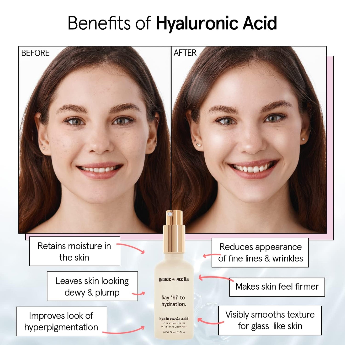 grace & stella Award Winning Hyaluronic Acid Serum (50ml/1.7 fl oz) Hy