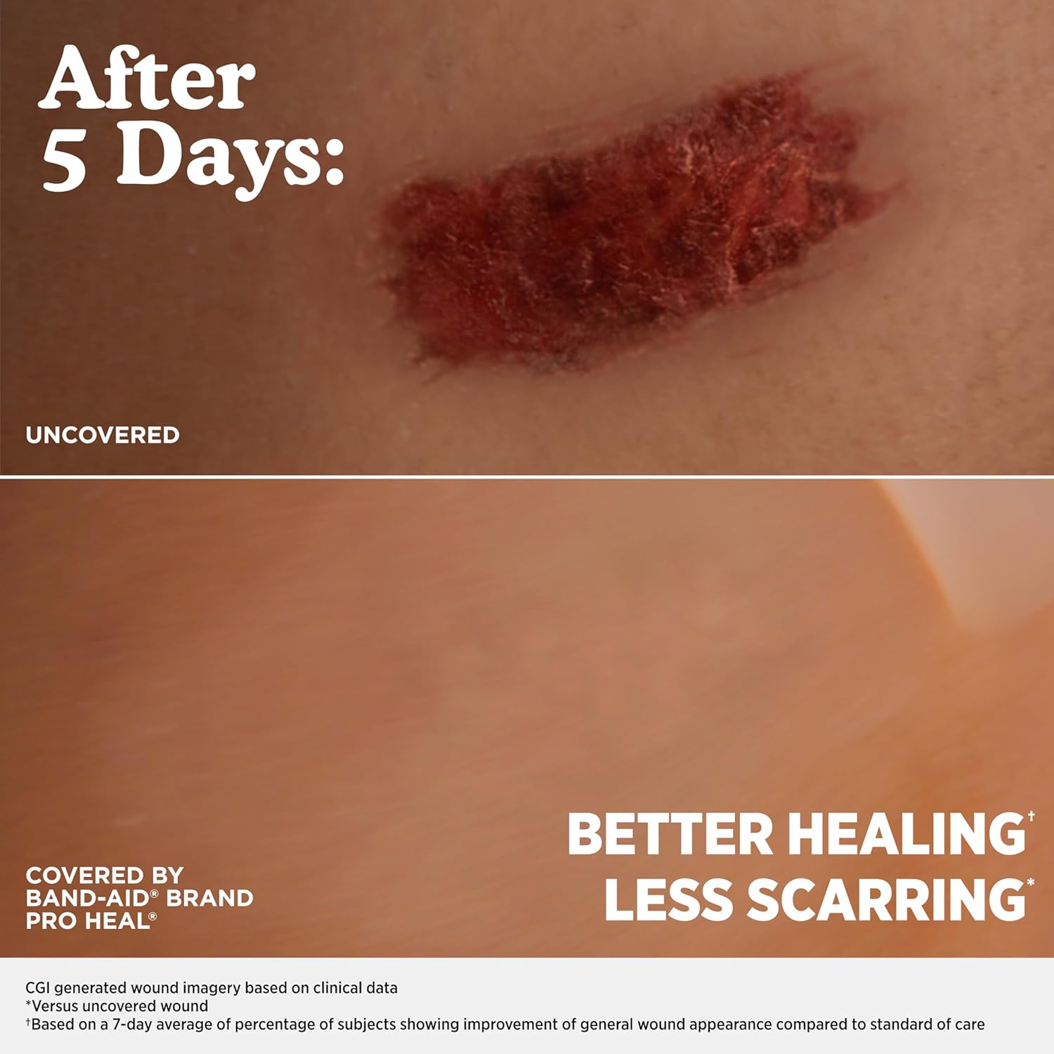 BAND-AID Brand Pro Heal Hydrocolloid Blister Bandages for Advanced Hea