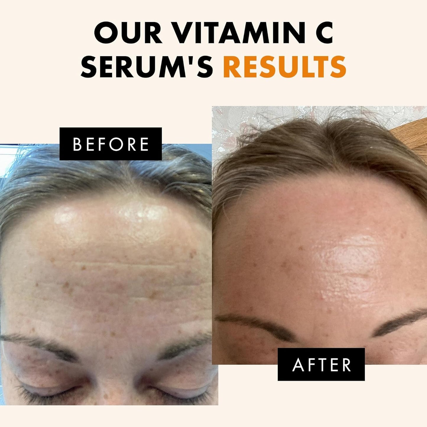Eclat Skincare Vitamin C Serum - Skin Care for Dark Spots, Vitamin C S