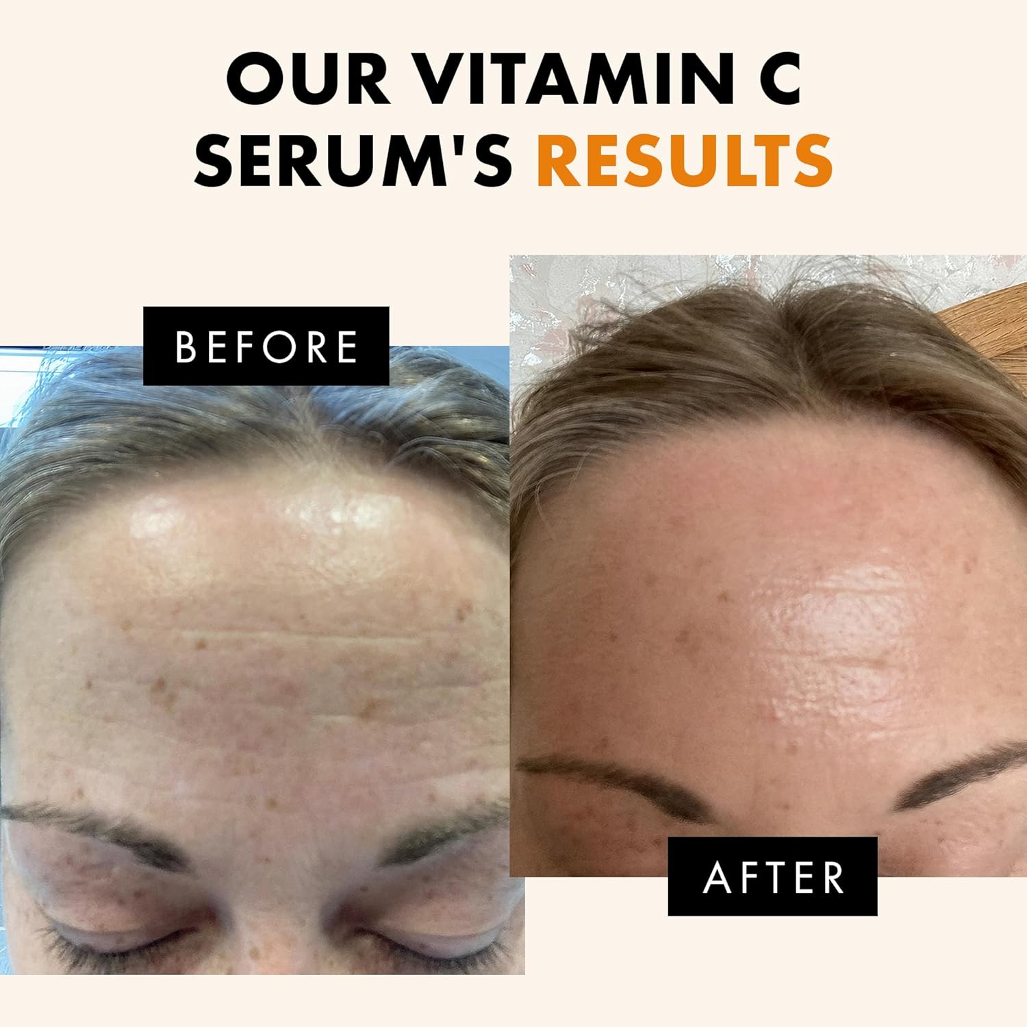 Eclat Skincare Vitamin C Serum - Skin Care for Dark Spots, Vitamin C S