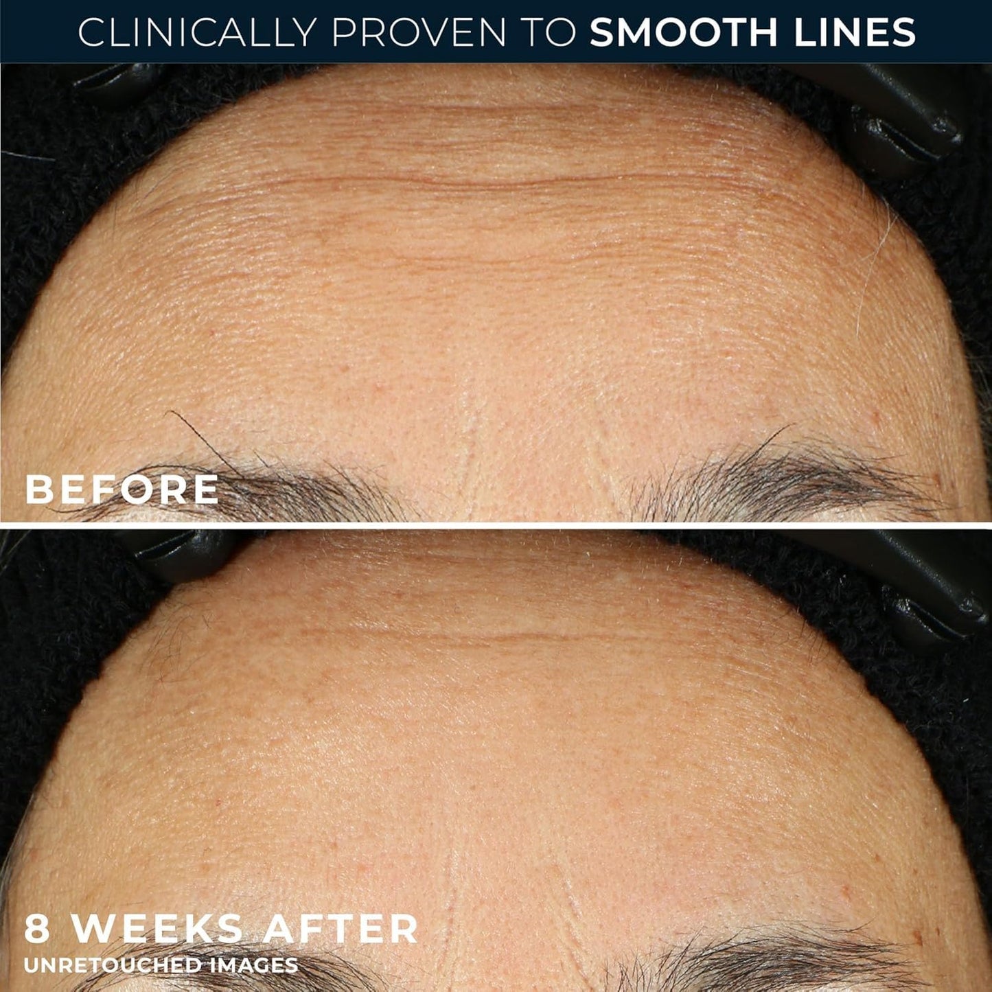 RoC Retinol Correxion Anti-Aging Wrinkle Night Serum, Retinol Serum fo