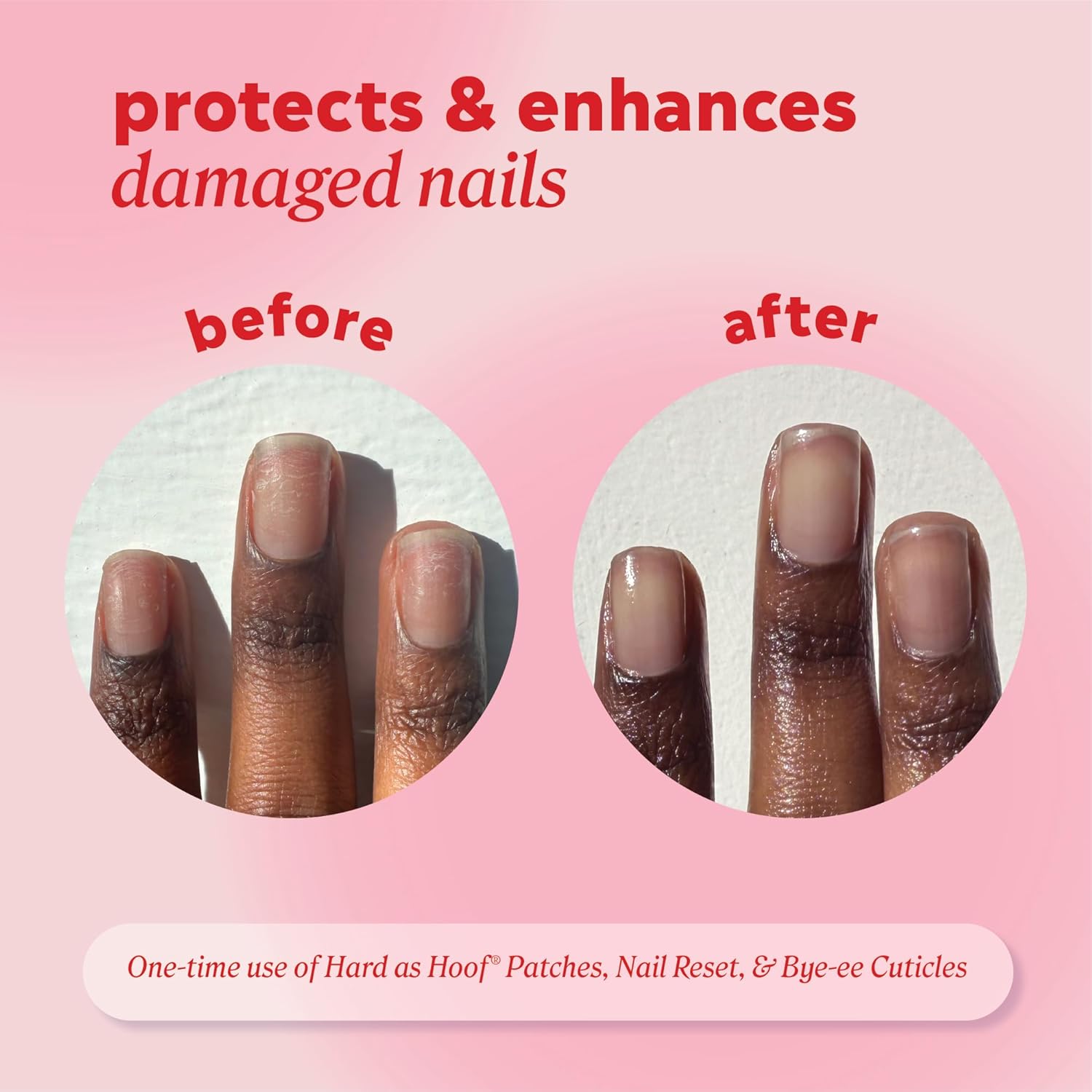 Onyx Professional Hard as Hoof S.O.S Nail Patches - Nail and Cuticle S