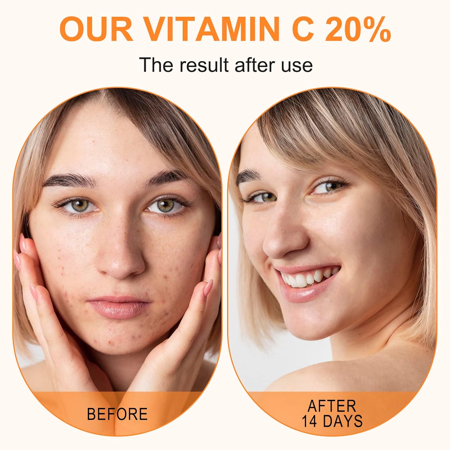 Premium 20% Vitamin C Serum For Face with Hyaluronic Acid, Retinol & A