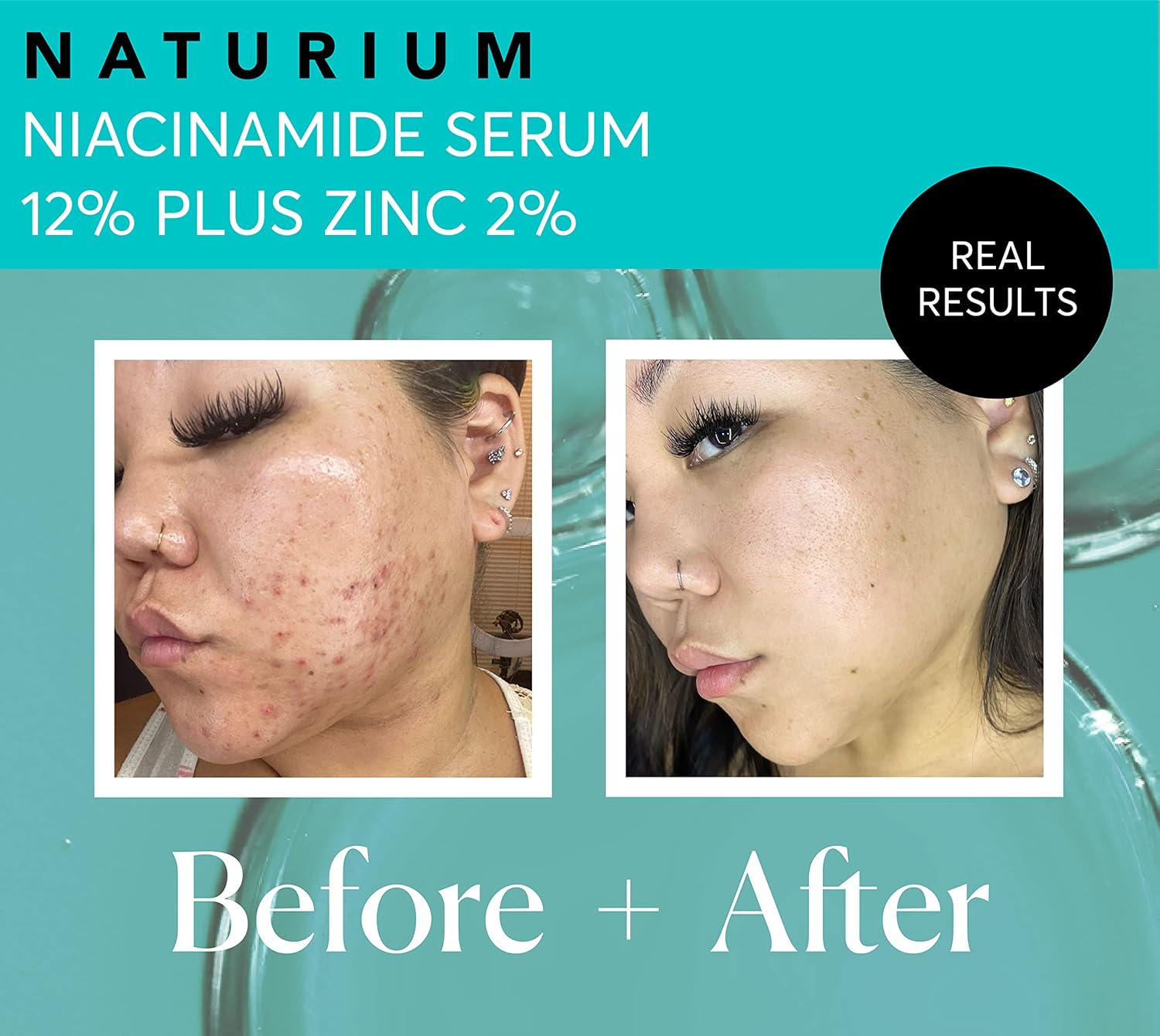 Naturium Niacinamide Face Serum 12% Plus Zinc 2%, Anti-Aging, Pore Min