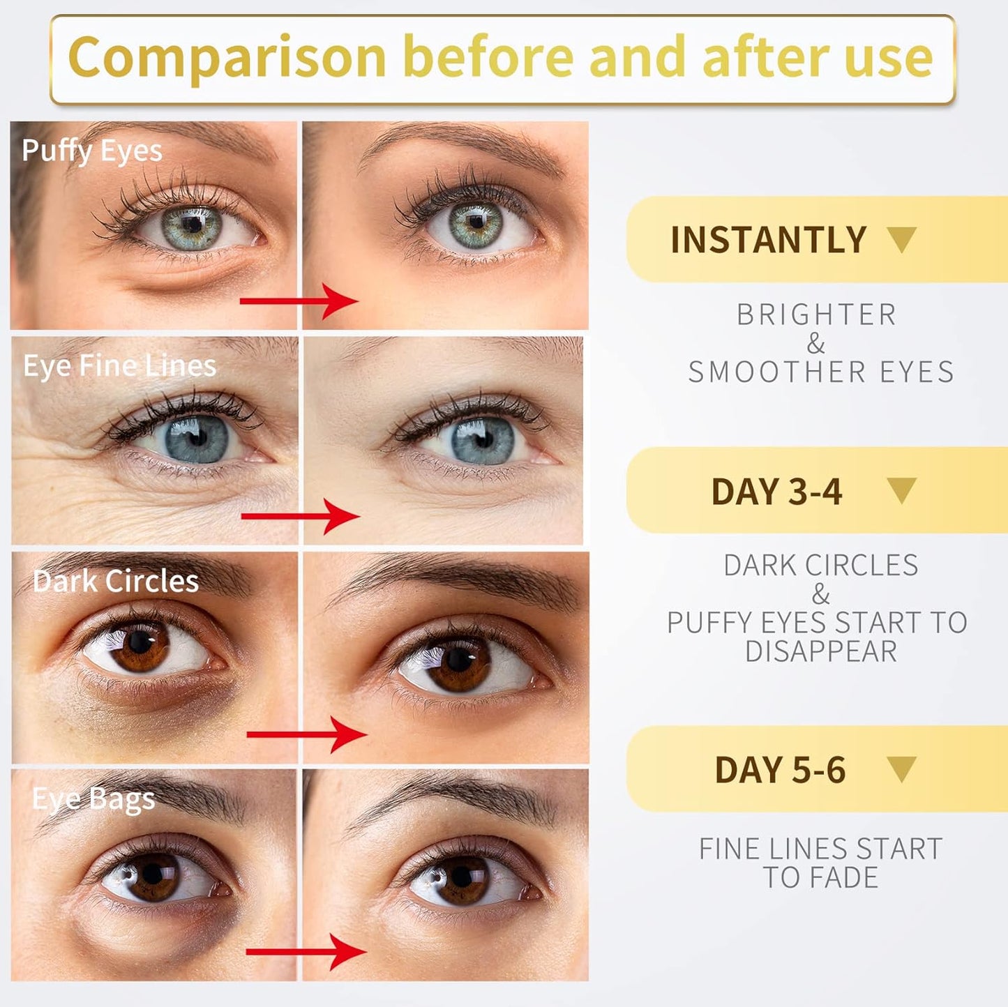 24K Gold Under Eye Patches - 60 Pack for Puffy Eyes, Dark Circles, Bag