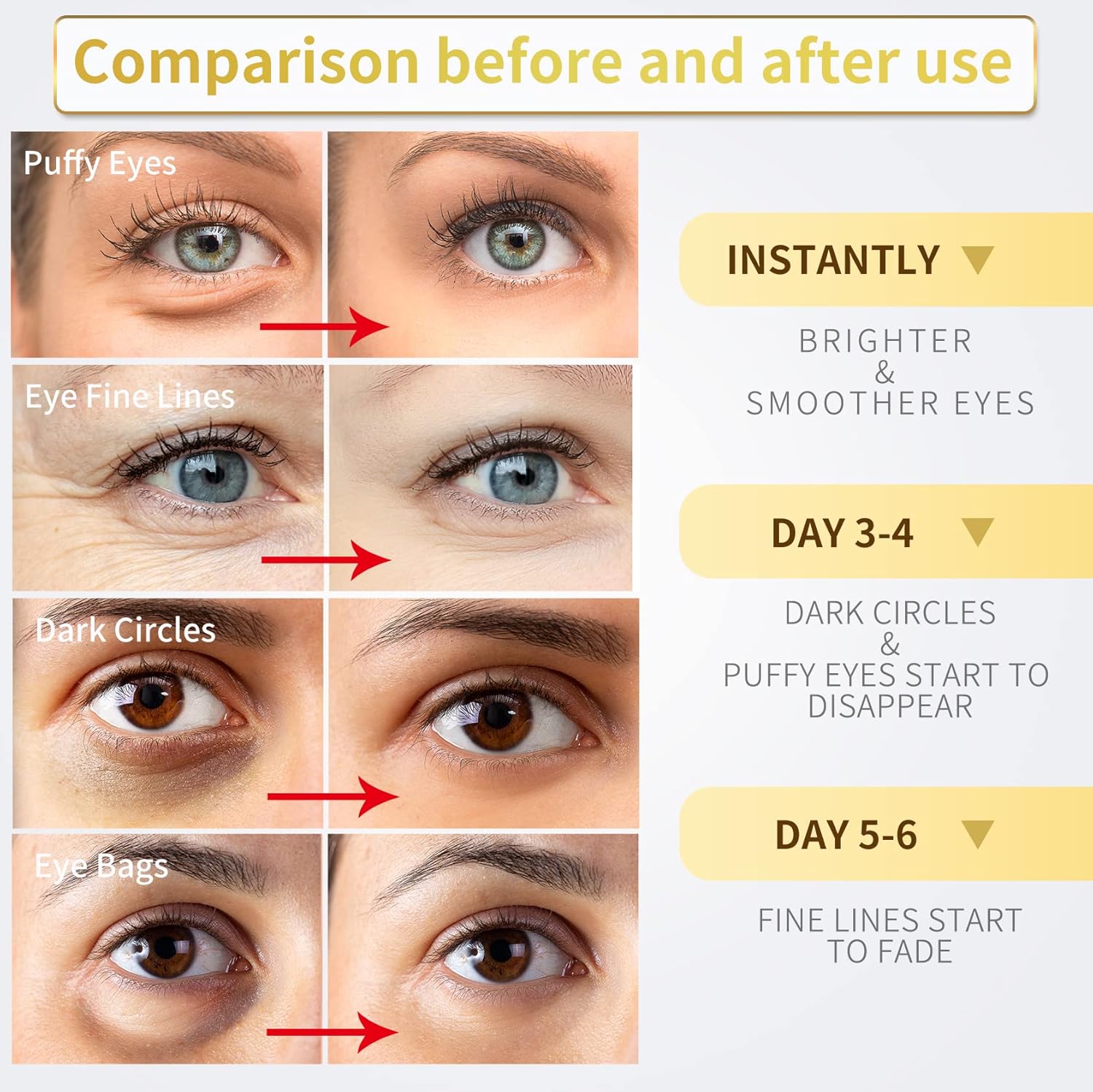 24K Gold Under Eye Patches - 60 Pack for Puffy Eyes, Dark Circles, Bag
