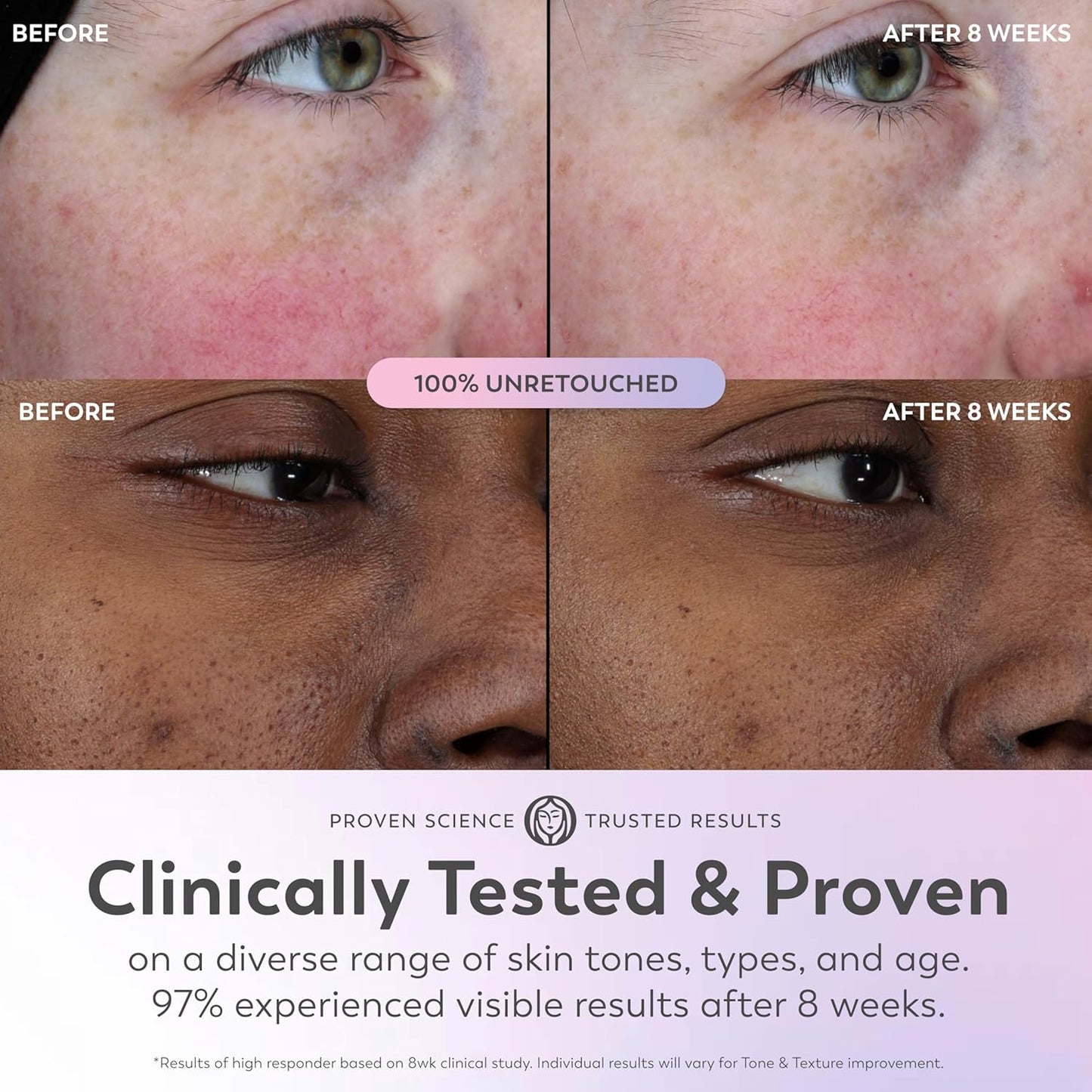 Olay Super Serum - Glow Serum for Face - Activated Niacinamide, Vitami