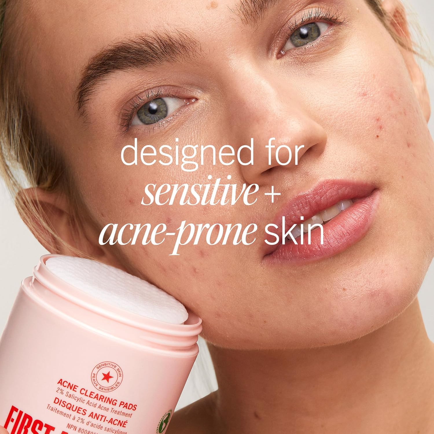 First Aid Beauty Acne Pads for Face - Maximum Strength Acne Treatment 
