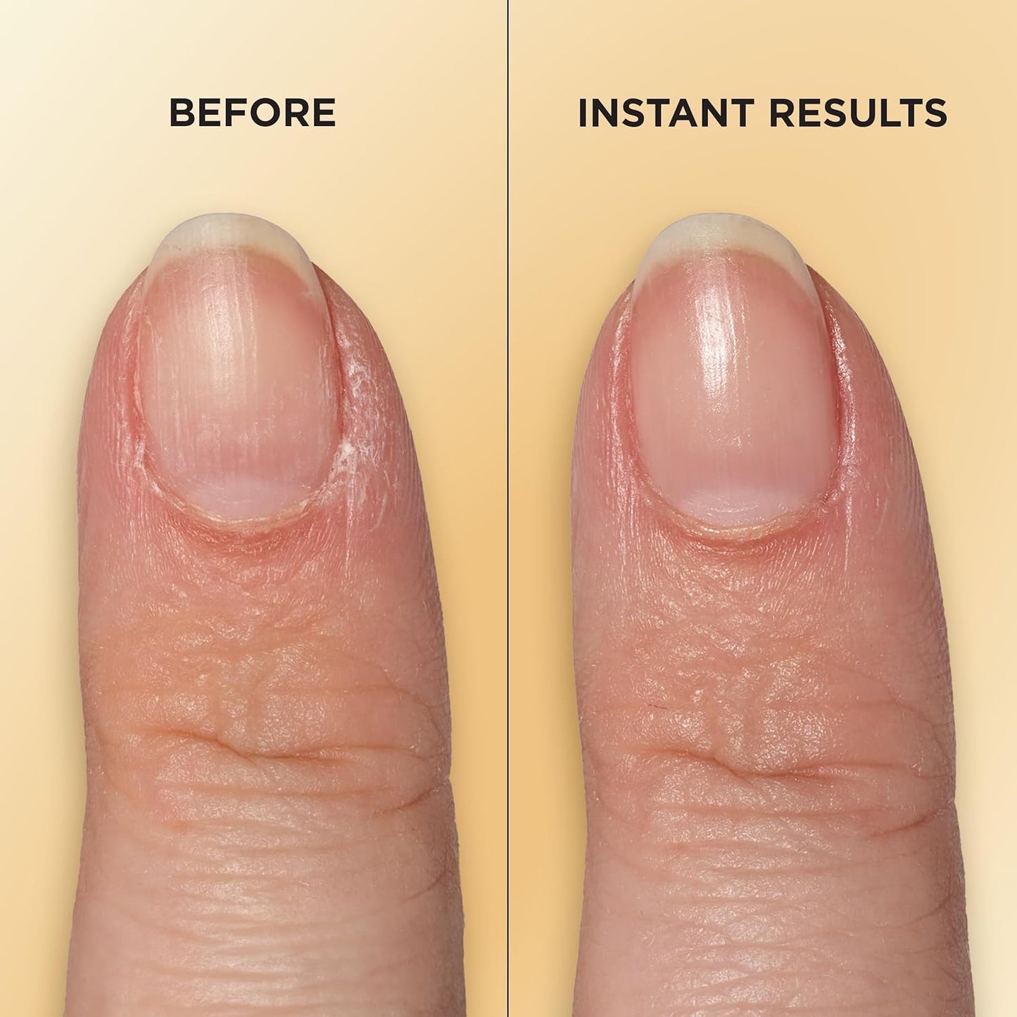 Sally Hansen Vitamin E Nail & Cuticle Treatment Pen | Hydrates and Con