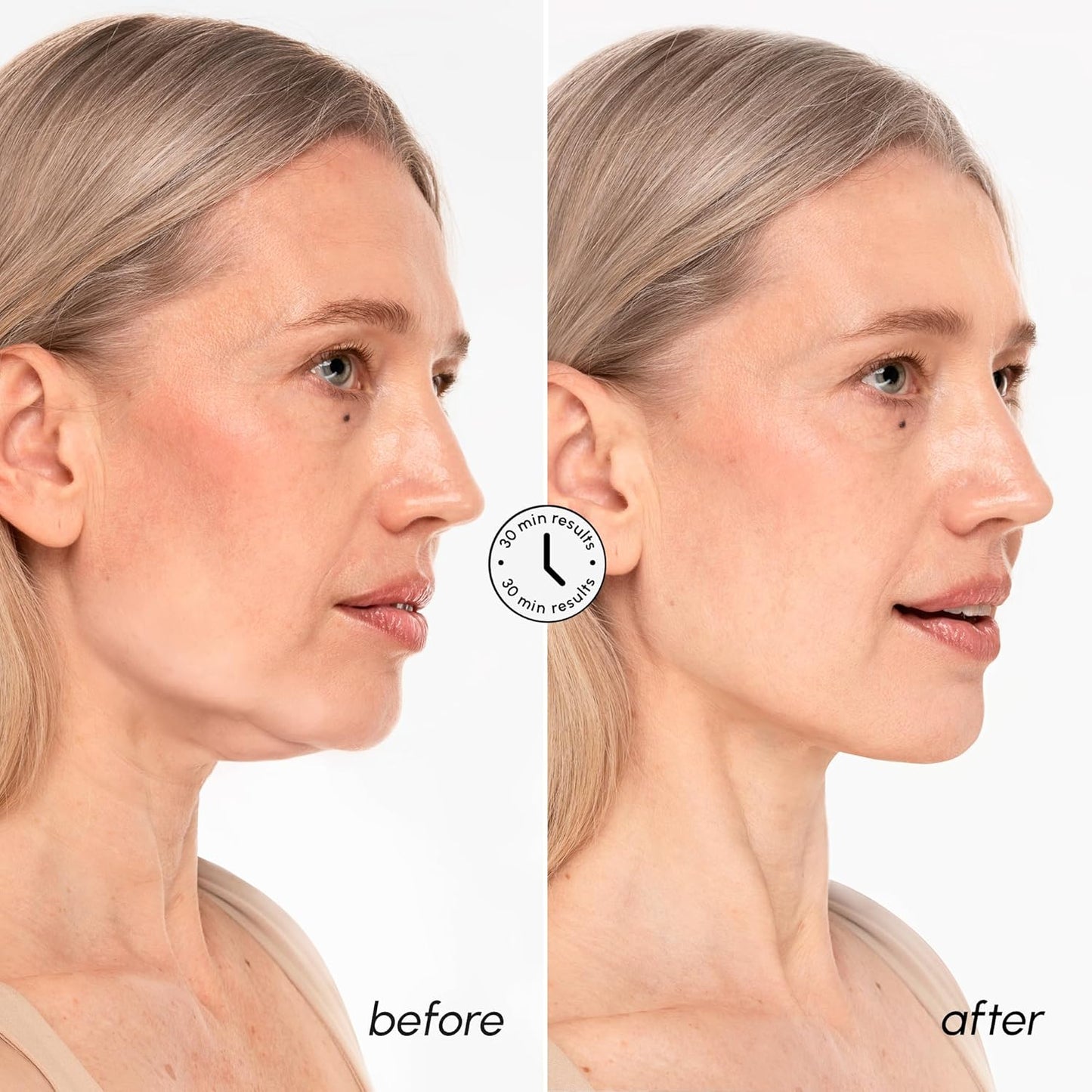 MAREE V Line Lifting Mask with 24K Gold – Deep Collagen Face Mask for 