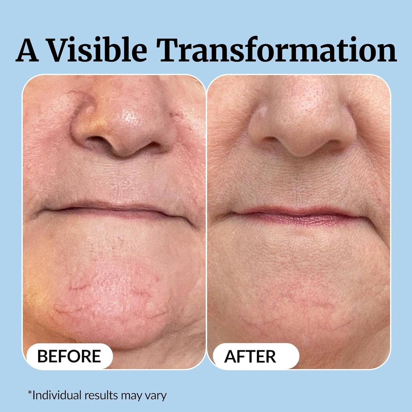 Vibriance Super C Serum for Mature Skin - All-in-One Vitamin Formula H