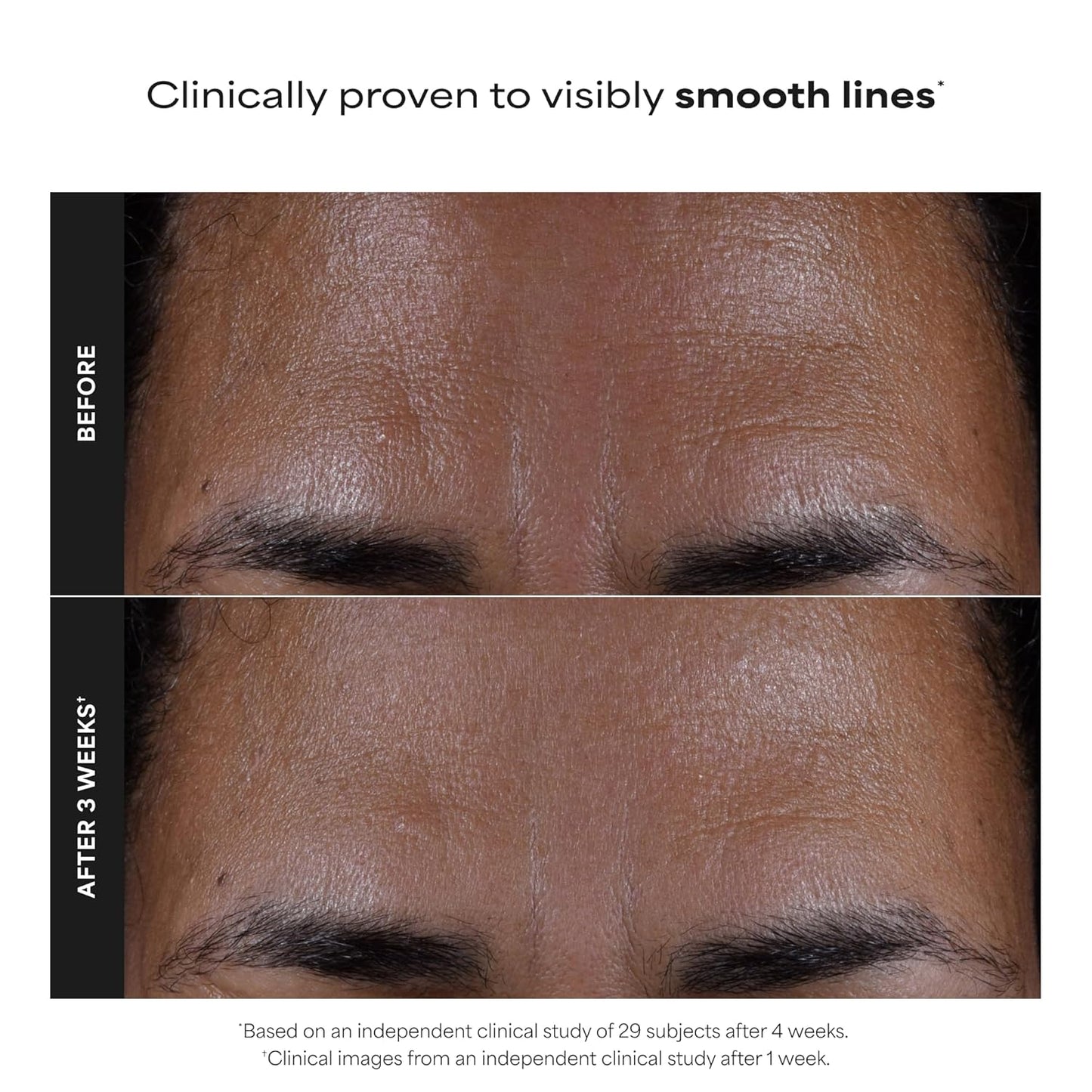 Paula's Choice SKIN PERFECTING 2% BHA Liquid Exfoliant with Salicylic 