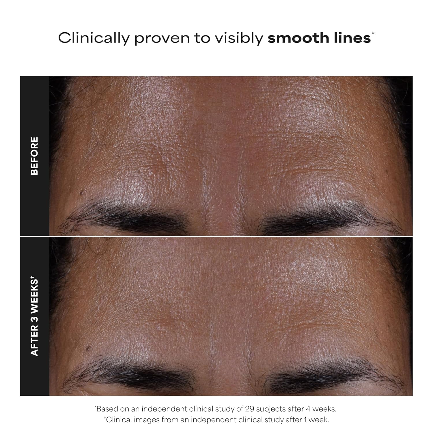Paula's Choice SKIN PERFECTING 2% BHA Liquid Exfoliant with Salicylic 