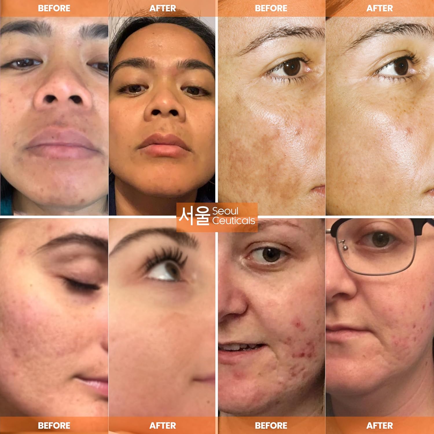 SeoulCeuticals Korean Skin Care 20% Vitamin C Hyaluronic Acid Serum + 