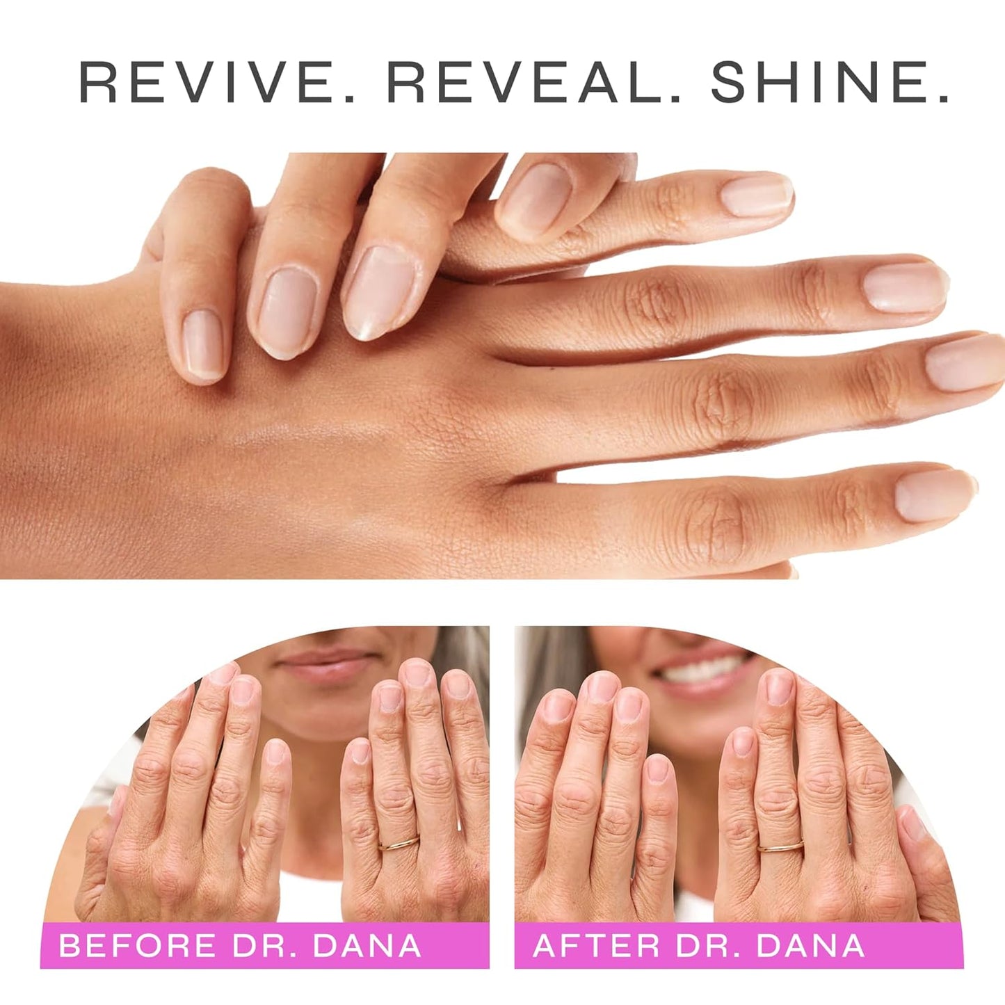 Dr. Dana Nail Repair Kit for Damaged Nails – Strengthening & Exfoliati